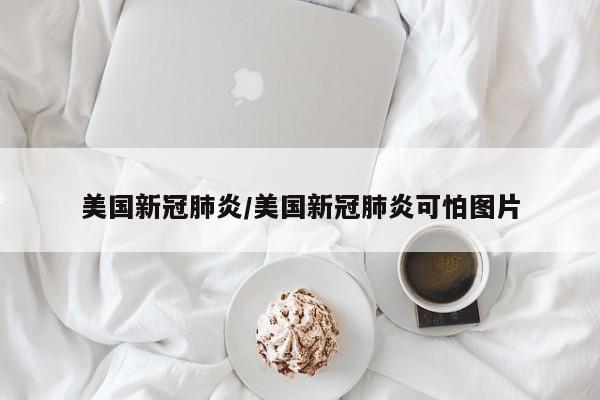 美国新冠肺炎/美国新冠肺炎可怕图片